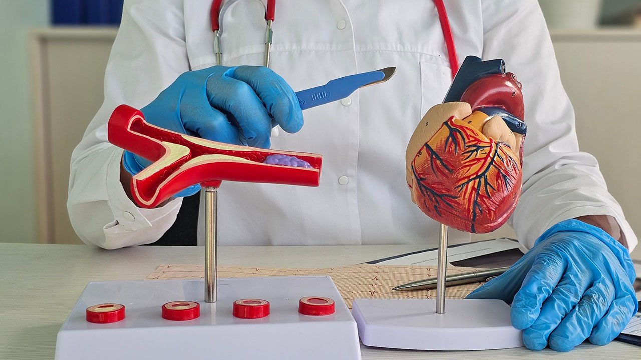 Coronary Angioplasty Procedure