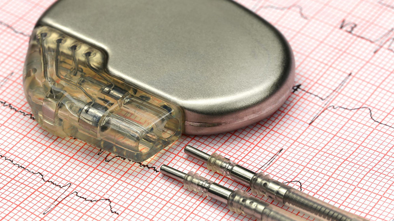 Pacemaker & ICD Implantation